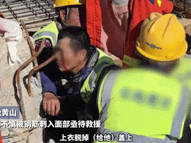 胆小勿入！钢筋插入面部